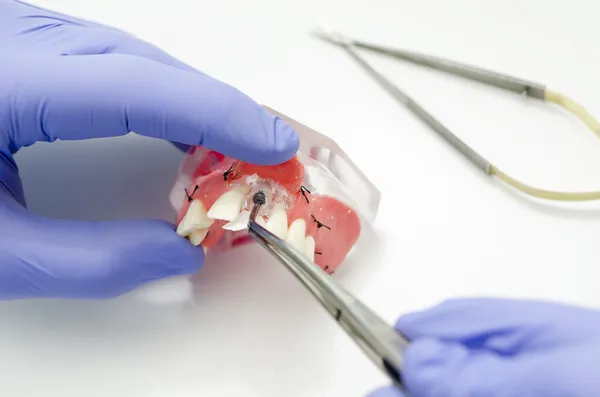 Diferentes técnicas de sutura en odontología y cuándo utilizar cada una