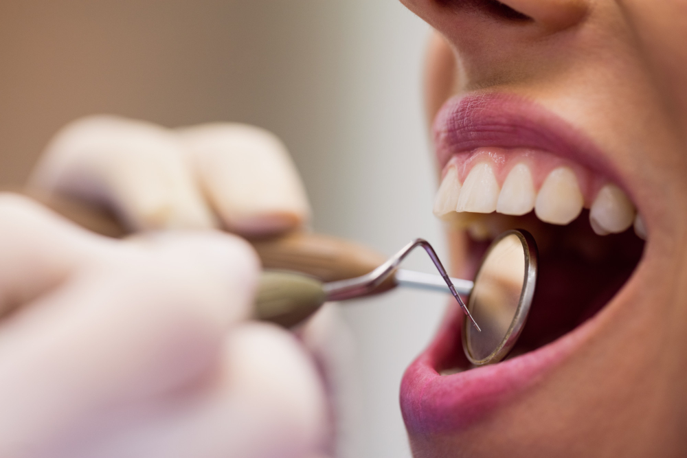 implante dental justo después de la extracción