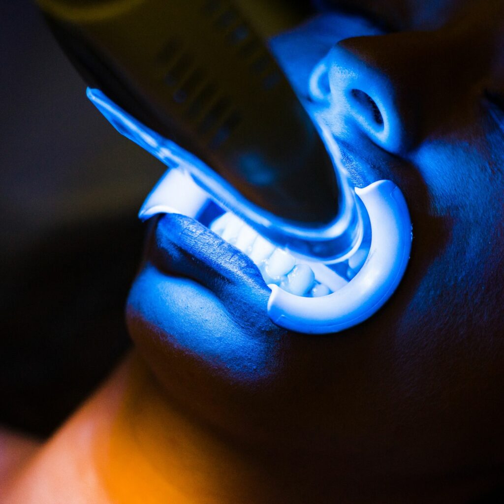 ¿Cómo funciona el blanqueamiento dental con láser?