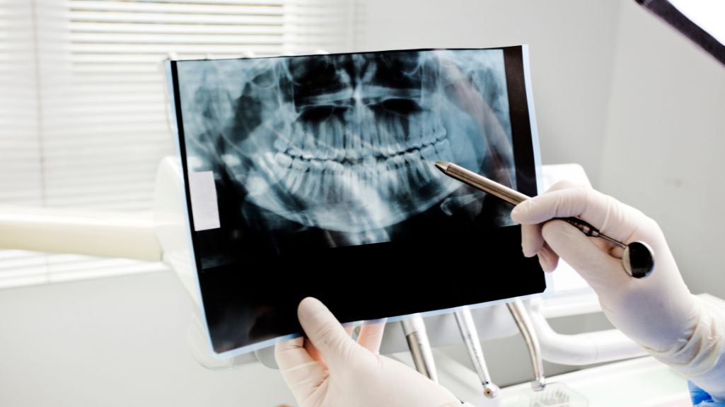 Cómo la odontología digital está reduciendo el tiempo y el dolor de los tratamientos