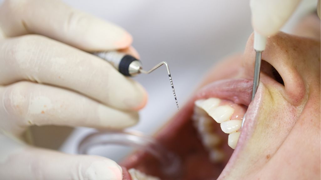Los tratamientos dentales más avanzados contra la periodontitis