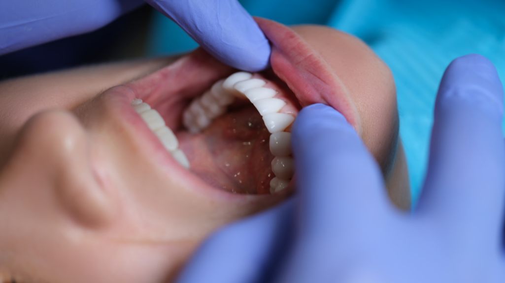 Odontología mínimamente invasiva: La opción más saludable y estética para tu boca
